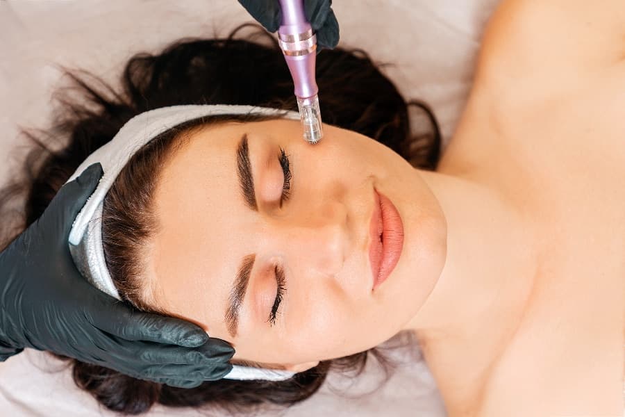 Sesión de dermapen facial en Aura Estética Avanzada, Rivas-Vaciamadrid