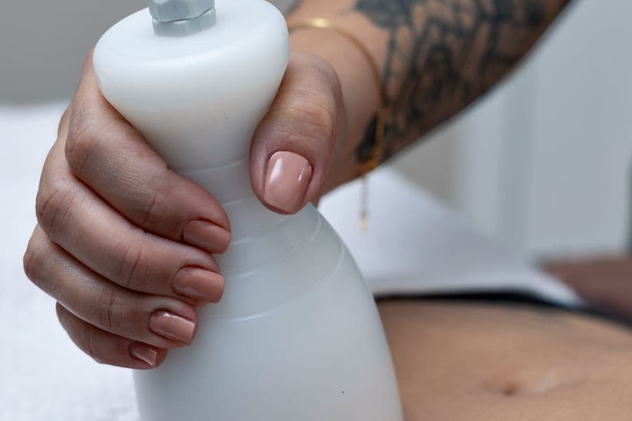 Sesión de HIFU corporal en Aura Estética Avanzada, Rivas-Vaciamadrid
